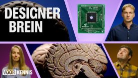Chip in je hoofd: Zo upgraden we ons brein 🧠